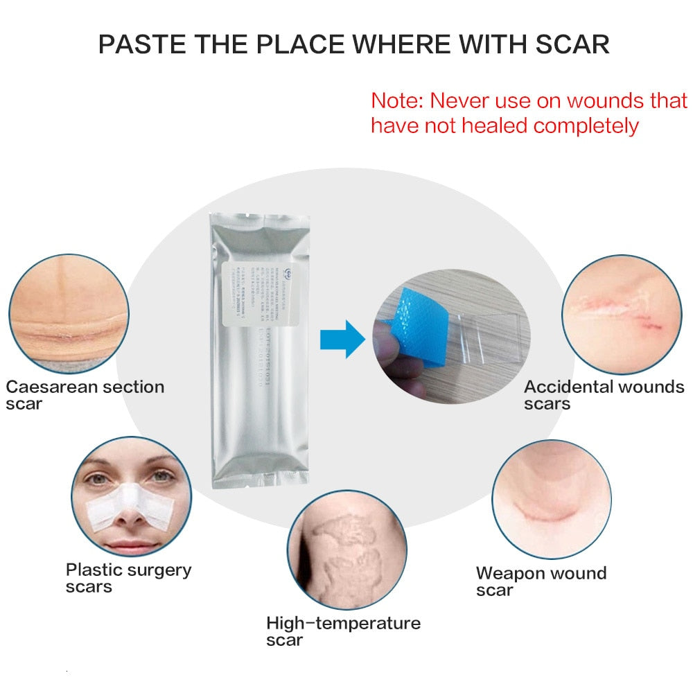 Miracle Scar Removal Tape - 4 Seasons Home Gadgets